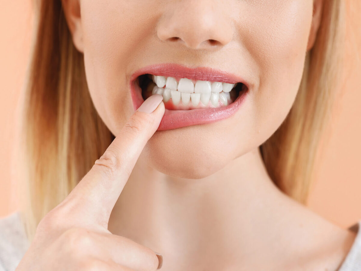 The Connection Between Orthodontics And Gum Disease