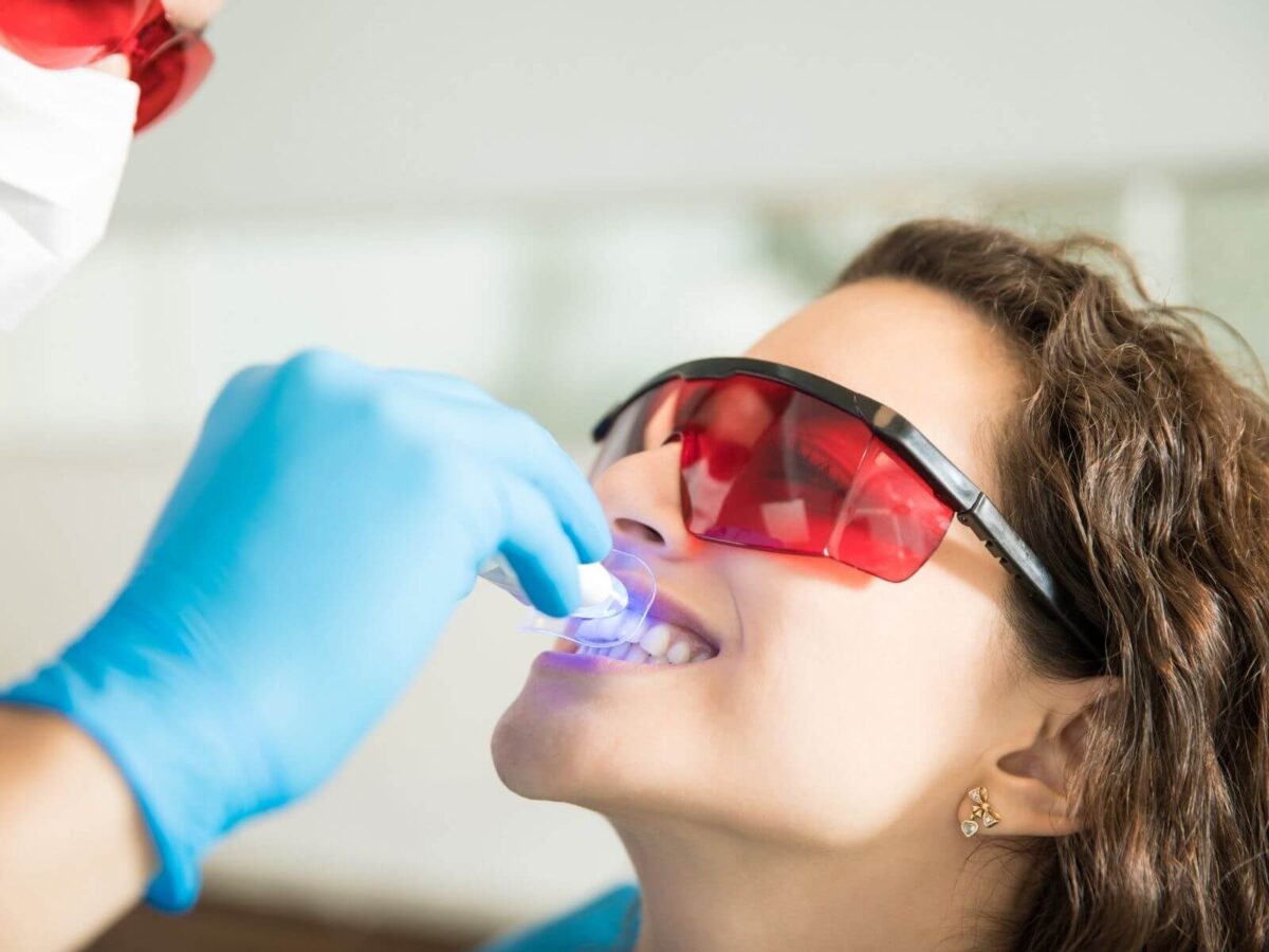 Teeth Whitening Options From Your Cosmetic Dentist